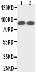 Anti-TrkA antibody used in Western Blot (WB). GTX12390