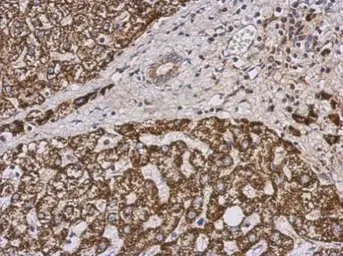 Anti-PECI antibody used in IHC (Paraffin sections) (IHC-P). GTX123947
