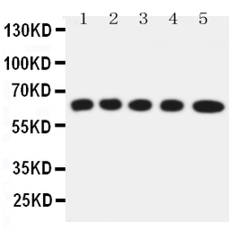 Anti-SLC22A5 antibody used in Western Blot (WB). GTX12395