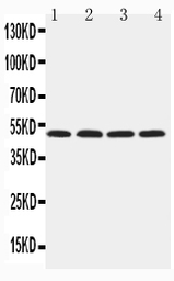 Anti-HYAL1 antibody used in Western Blot (WB). GTX12396