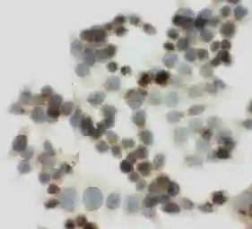 Anti-IGF2R antibody used in Immunocytochemistry/ Immunofluorescence (ICC/IF). GTX12397