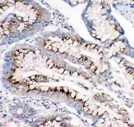 Anti-IGF2R antibody used in IHC (Paraffin sections) (IHC-P). GTX12397