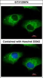 Anti-ALDH1A1 antibody used in Immunocytochemistry/ Immunofluorescence (ICC/IF). GTX123974