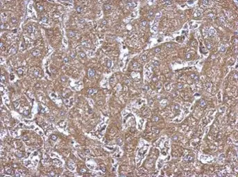 Anti-ALDH1A1 antibody used in IHC (Paraffin sections) (IHC-P). GTX123974