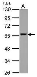 Anti-ALDH1A1 antibody used in Western Blot (WB). GTX123974