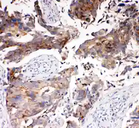 Anti-SLC16A4 antibody used in IHC (Paraffin sections) (IHC-P). GTX12399