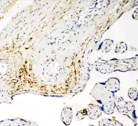 Anti-SLC16A4 antibody used in IHC (Paraffin sections) (IHC-P). GTX12399