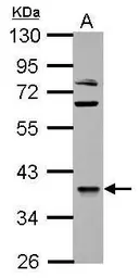 Anti-OXSM antibody used in Western Blot (WB). GTX124011
