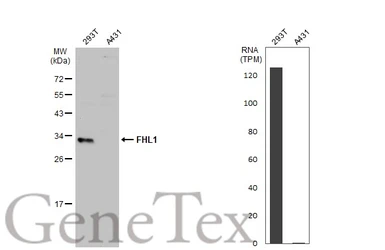 Anti-FHL1 antibody used in Western Blot (WB). GTX124042