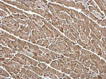 Anti-FHL1 antibody used in IHC (Paraffin sections) (IHC-P). GTX124042