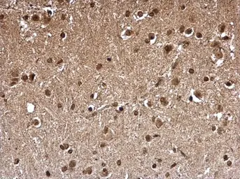 Anti-FHL1 antibody used in IHC (Paraffin sections) (IHC-P). GTX124042