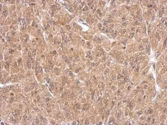 Anti-FHL1 antibody used in IHC (Paraffin sections) (IHC-P). GTX124042