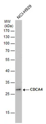 Anti-CDCA4 antibody used in Western Blot (WB). GTX124045