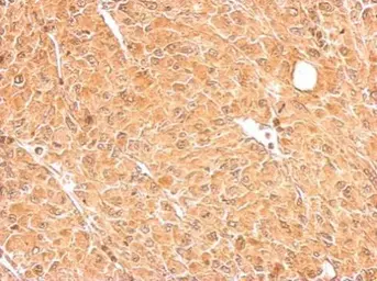 Anti-GALM antibody used in IHC (Paraffin sections) (IHC-P). GTX124062