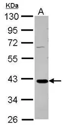 Anti-GALM antibody used in Western Blot (WB). GTX124062