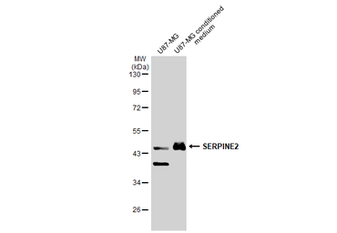 Anti-SERPINE2 antibody used in Western Blot (WB). GTX124069