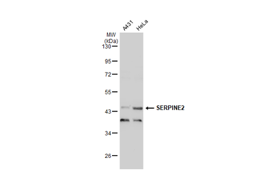 Anti-SERPINE2 antibody used in Western Blot (WB). GTX124069