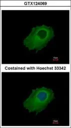 Anti-SERPINE2 antibody used in Immunocytochemistry/ Immunofluorescence (ICC/IF). GTX124069