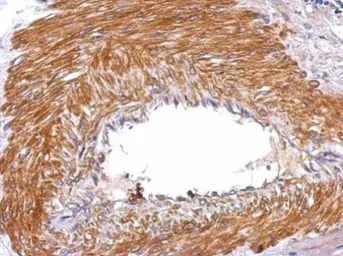 Anti-SERPINE2 antibody used in IHC (Paraffin sections) (IHC-P). GTX124069