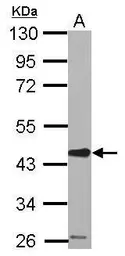 Anti-SERPINE2 antibody used in Western Blot (WB). GTX124069
