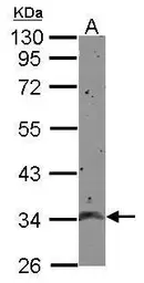 Anti-CCDC90A antibody used in Western Blot (WB). GTX124078