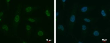 Anti-POLR2D antibody used in Immunocytochemistry/ Immunofluorescence (ICC/IF). GTX124081