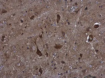 Anti-KIFC2 antibody [N3C2], Internal used in IHC (Paraffin sections) (IHC-P). GTX124082