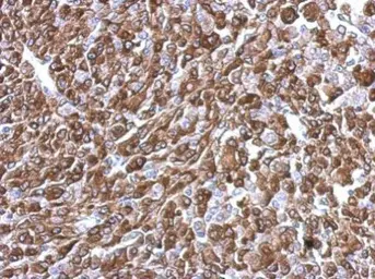 Anti-KIFC2 antibody [N3C2], Internal used in IHC (Paraffin sections) (IHC-P). GTX124082