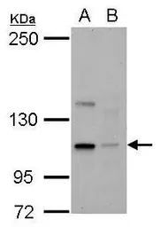 Anti-KIFC2 antibody [N3C2], Internal used in Western Blot (WB). GTX124082