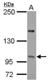 Anti-PP4R4 antibody [C2C3], C-term used in Western Blot (WB). GTX124107