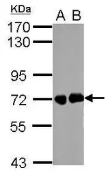 Anti-Helicobacter pylori urease B antibody used in Western Blot (WB). GTX124109