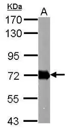 Anti-Helicobacter pylori urease B antibody used in Western Blot (WB). GTX124110
