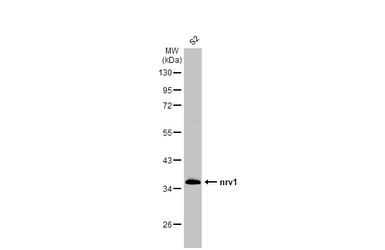 Anti-nrv1 antibody [N1N2], N-term used in Western Blot (WB). GTX124111