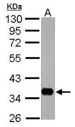 Anti-nrv1 antibody [N1N2], N-term used in Western Blot (WB). GTX124111
