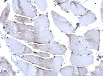 Anti-Histone H3R17me2 (Asymmetric Di-methyl Arg17) antibody used in IHC (Paraffin sections) (IHC-P). GTX124113