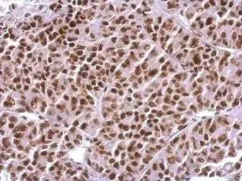Anti-Histone H3R17me2 (Asymmetric Di-methyl Arg17) antibody used in IHC (Paraffin sections) (IHC-P). GTX124113