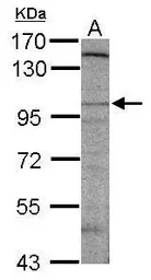 Anti-Dlgap2 antibody used in Western Blot (WB). GTX124116
