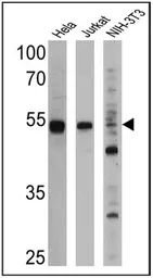 Anti-PPAR alpha antibody [3B6/PPAR] used in Western Blot (WB). GTX12412