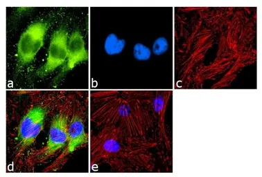 Anti-PPAR alpha antibody [3B6/PPAR] used in Immunocytochemistry/ Immunofluorescence (ICC/IF). GTX12412