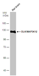 Anti-DLK/MAP3K12 antibody used in Western Blot (WB). GTX124127