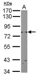 Anti-RAD3 antibody [N1N2], N-term used in Western Blot (WB). GTX124133