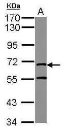 Anti-Mre11 antibody [C1C3] used in Western Blot (WB). GTX124144