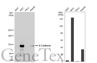 Anti-E-Cadherin antibody [N3C2], Internal used in Western Blot (WB). GTX124178