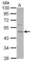 Anti-Protor 1 antibody used in Western Blot (WB). GTX124179