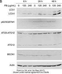 Anti-ATG12 antibody used in Western Blot (WB). GTX124181