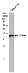 Anti-CORD2 antibody used in Western Blot (WB). GTX124188