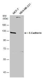 Anti-E-Cadherin antibody used in Western Blot (WB). GTX124198