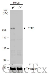 Anti-TET2 antibody [N2], N-term used in Western Blot (WB). GTX124204