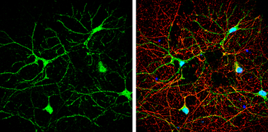 Anti-iNOS antibody [N1N2-2], N-term used in Immunocytochemistry/ Immunofluorescence (ICC/IF). GTX124210