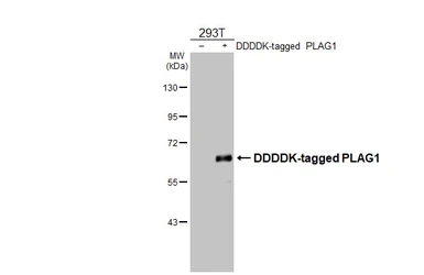 Anti-PLAG1 antibody used in Western Blot (WB). GTX124217